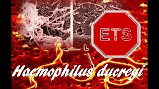 Chancroide Haemophilus ducreyi [upl. by Eirena]