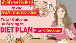 सिजेरियन डिलीवरी के बाद क्या खाये और क्या खाने से बचे  Diet Food After Cesarean Delivery [upl. by Euqor]