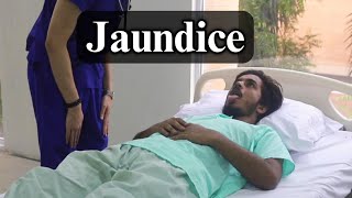 Jaundice  Standardized Clinical Examination Videos  KYAMC [upl. by Buckden]