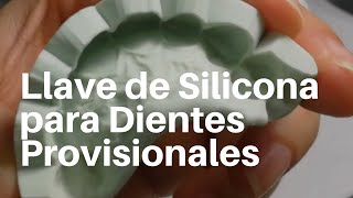 Como hacer una LLAVE❓de SILICON👅para DIENTES PROVISIONALES Paso a PAso dentaltip speedex [upl. by Sire]