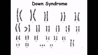 8 Karyotype [upl. by Attiuqram12]