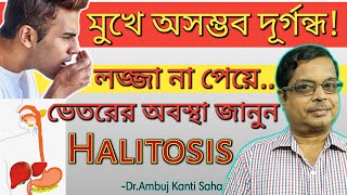 Halitosis permanent treatment  Bad smell  Bad breath  Fetor oris  home remedies and homeopathy [upl. by Adihaj189]