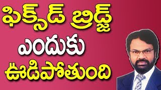 ఫిక్స్డ్ బ్రిడ్జ్ ఎందుకు ఊడిపోతుంది  Fixed Bridge Teeth Procedure  Fixed Bridge  Dr Raos Dental [upl. by Lerad680]