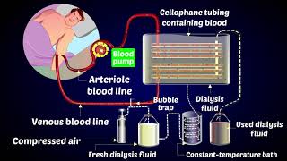 How a Dialysis Machine Works  Dialysis  ARTIFICIAL KIDNEYS [upl. by Ahsieat556]