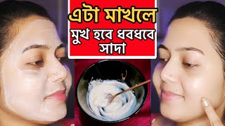 এটা মাখলে  ঘরে বসেই মুখ হবে ধবধবে সাদাmukhar Kalo dag dur korar upaiskin whitening packDtan pack [upl. by Skelton]