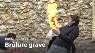 Premiers secours  Brûlure grave  Secourisme [upl. by Mutua]