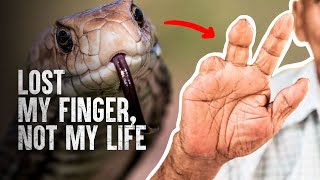 How to Survive The Most Dangerous Snake Bites  Part 2 [upl. by Enirol]