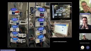 RV assessment in critically ill [upl. by Bigelow]