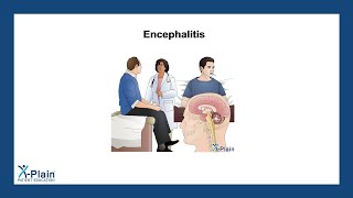 Encephalitis [upl. by Eciralc555]