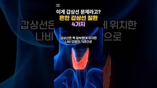 흔한 갑상선 질환 4가지갑상선 기능 항진증 갑상선 기능 저하증 갑상선 결절 갑상선암 증상🦋 [upl. by Inoliel663]