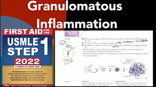 Granulomatous inflammation  Caseating amp Noncaseating necrosis in HindiUrdu  FMGE  NEET PG [upl. by Mortie]