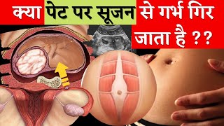 क्या पेट पर सूजन से बच्चा ख़राब हो जाता है  Inflammation amp fertility Issue  Youtube saheli [upl. by Thorlay]