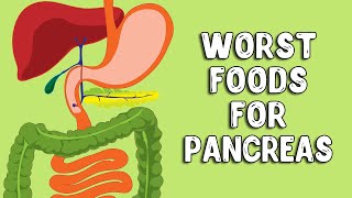 What Foods Irritate The Pancreas Pancreatitis Diet [upl. by Terr]