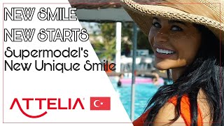 AMY REBECCAS NEW SMILE  ATTELIA DENTAL CLINIC TURKEY [upl. by Elaen]