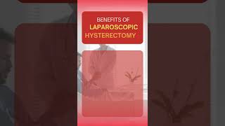 Benefits of Laparoscopic Hysterectomy [upl. by Nikolaos560]