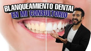 Así Hago un Blanqueamiento Dental en mi Consultorio CASO REAL ANTES Y DESPUÉS [upl. by Nilsoj]