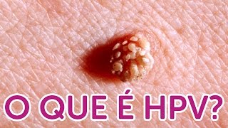 Tudo que você quer saber sobre HPV [upl. by Kuhlman]