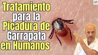 🚨 PICADURA DE GARRAPATA EN HUMANOS TRATAMIENTO MÁS EFECTIVO 🚨 [upl. by Arundell]