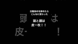 【別人】白髪染めを辞めただけ [upl. by Bethel]