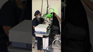 Retinal Laser Surgery Barrage laser in 2 minutes [upl. by Lazare]