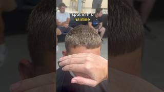 Tutorial on How to permanently fix and lay down a cowlick on the hairline barbertutorial [upl. by Hillman]