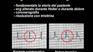 Angina pectoris [upl. by Olinad7]