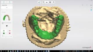 Getting Started With 3Shape Copy Denture [upl. by Hannavahs]