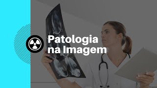 Anatomia Radiológica 10  Patologias na Imagem de Tórax [upl. by Apollo]