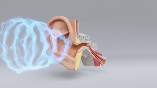 Explore the Science of Hearing Loss  MiracleEar Hearing Center [upl. by Lehctim]