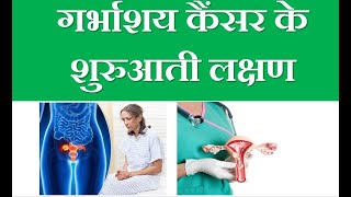 Uterus cancer symptoms in hindi [upl. by Tarazi]