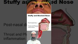 Stuffy and Blocked Nose  Part 1  Urdu  Hindi  Shahbaz Qamar [upl. by Eceela]