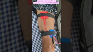 Placement of electrode for neuromuscular electrical muscle stimulation for ms reeducationshorts [upl. by Prichard]