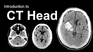 Introduction to CT Head Approach and Principles [upl. by Asaph]