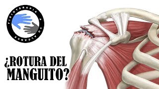 ¿Dolor de hombro 3 test para saber si tu manguito rotador tiene una lesion o esta roto [upl. by Llyrat]