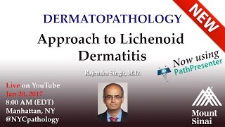 Dermatopathology Approach to Lichenoid Dermatitis  w Dr Singh [upl. by Oetam643]