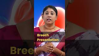 Breech presentation pregnancytips normaldelivery baby drsavitha udumalpet [upl. by Einor601]