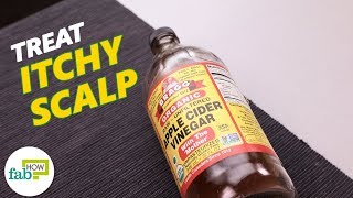 How to Get Rid of Itchy Scalp Top 3 Home Remedies [upl. by Nager417]