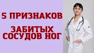 5 признаков забитых сосудов ног Как проверить [upl. by Montanez]