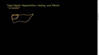 31 Tissue Repair Regeneration Healing Fibrosis [upl. by Hoxsie304]