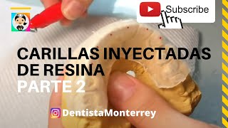 CARILLAS DIRECTAS PASO a PASO👅Parte 2 Técnica de Inyección carillasderesina [upl. by Madlen]