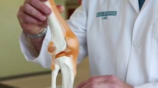 What is Runner’s Knee  Pain in knee when walking  Runners Knee Pain [upl. by Bonner]