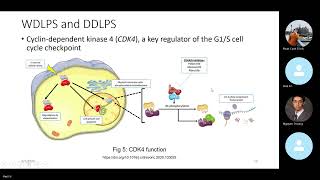 JCS 6 Liposarcoma [upl. by Olegnalehcim]