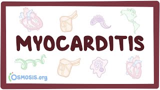 Myocarditis  causes symptoms diagnosis treatment pathology [upl. by Airekahs880]