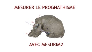 Mesurer langle facial prognathisme dans Mesurim2 [upl. by Wixted]