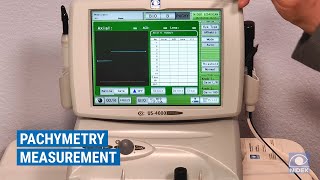 NIDEK US4000500 Ultrasound  Pachymetry Overview [upl. by Waldon404]