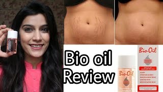 Bio Oil Review In Hindi  Remove Stretch MarksScars  Super Style Tips [upl. by Dib]