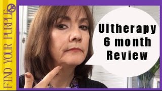 Ultherapy 6 month Review [upl. by Olav]