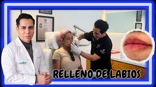 EMBELLECIMIENTO de LABIOS con ÁCIDO HIALURÓNICO I JAVIER DERMA [upl. by Asus]