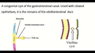 Embryology of vitellointestinal duct  formation fate amp congenital anomalies [upl. by Drusilla]