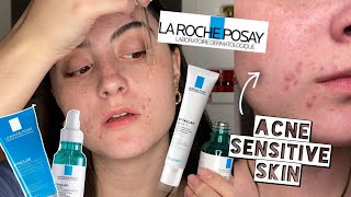 TESTING LA ROCHE POSAY EFFECLAR SKINCARE ROUTINE ON ACNE SENSITIVE DRY SKIN FOR 2 WEEKS [upl. by Miguela870]